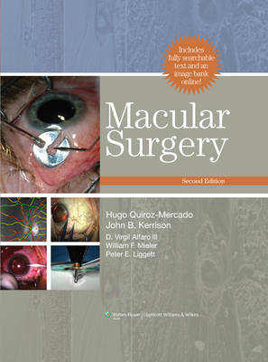 Macular Surgery - Hugo Quiroz-Mercado, John B. Kerrison, D.Virgil Alfaro, William F. Mieler, Peter E. Liggett