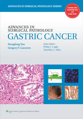 Advances in Surgical Pathology: Gastric Cancer - 