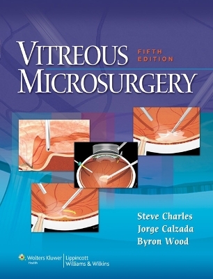 Vitreous Microsurgery - Steve Charles, Jorge Calzada, Byron Wood