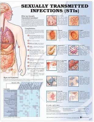 Sexually Transmitted Infections Anatomical Chart