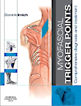 Myofascial Trigger Points - Dominik Irnich