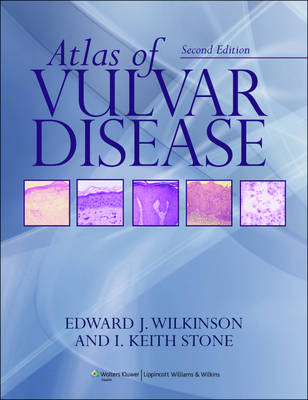 Atlas of Vulvar Disease - Edward J. Wilkinson, I. Keith Stone