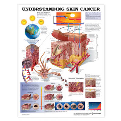 Understanding Skin Cancer Anatomical Chart