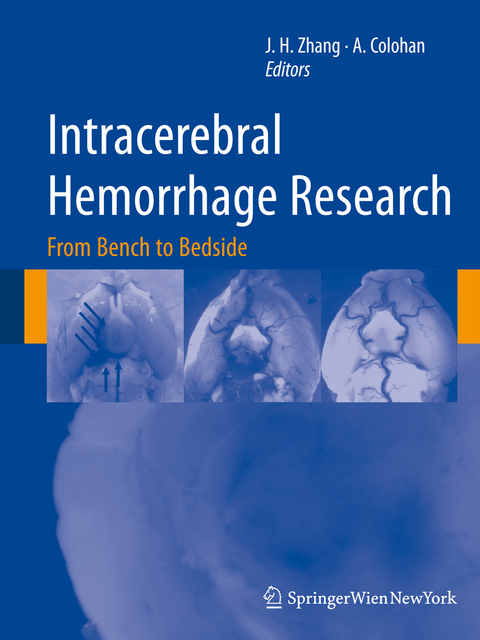 Intracerebral Hemorrhage Research - 