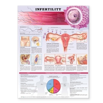 Infertility Anatomical Chart