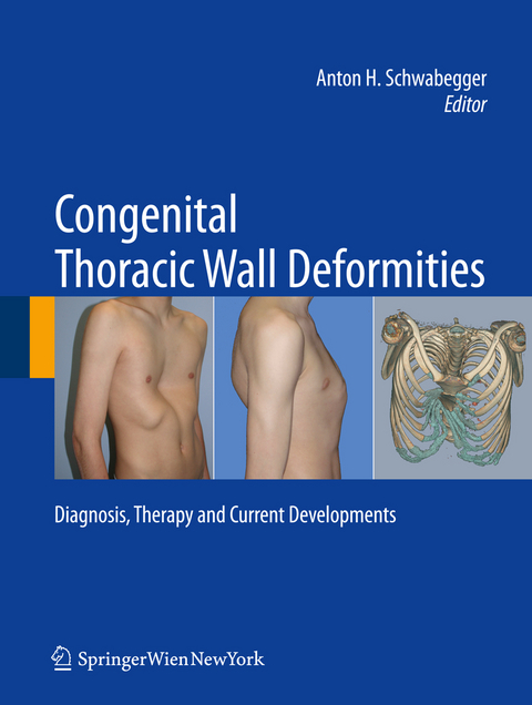 Congenital Thoracic Wall Deformities - 