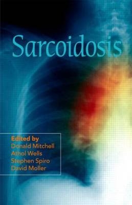 Sarcoidosis - 