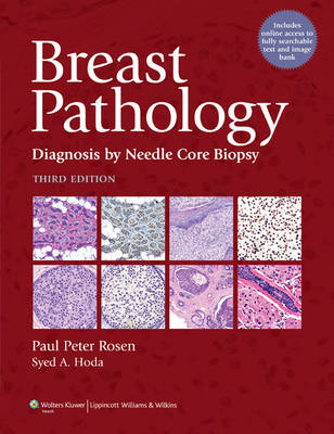 Breast Pathology - 