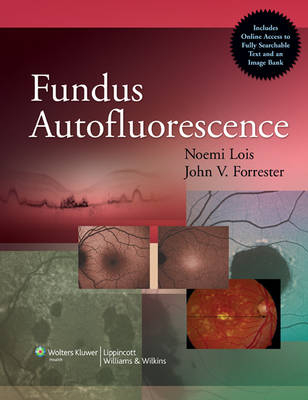 Fundus Autofluorescence - 