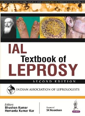 IAL Textbook of Leprosy - Bhushan Kumar, Hemanta Kumar Kar