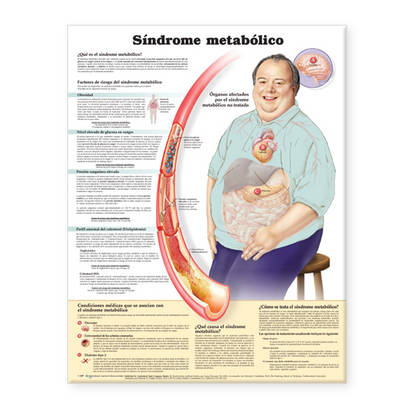 Metabolic Syndrome Anatomical Chart in Spanish (Síndrome metabólico)