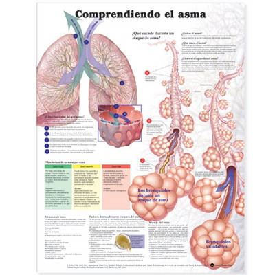 Understanding Asthma Anatomical Chart in Spanish (Entendiendo El Asma)