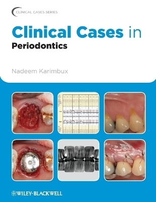 Clinical Cases in Periodontics - 