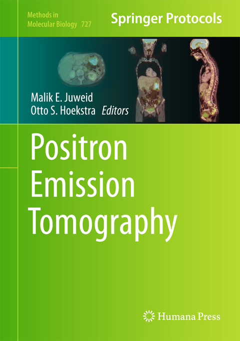 Positron Emission Tomography - 