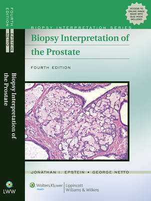 Biopsy Interpretation of the Prostate - Jonathan I. Epstein, George J. Netto