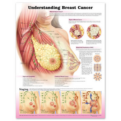 Understanding Breast Cancer