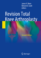 Revision Total Knee Arthroplasty - 