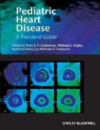 Paediatric Heart Disease - 