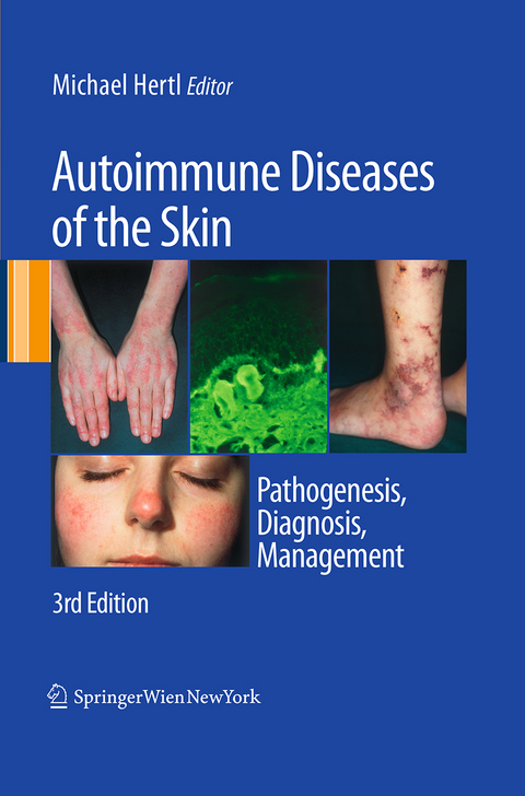 Autoimmune Diseases of the Skin - 