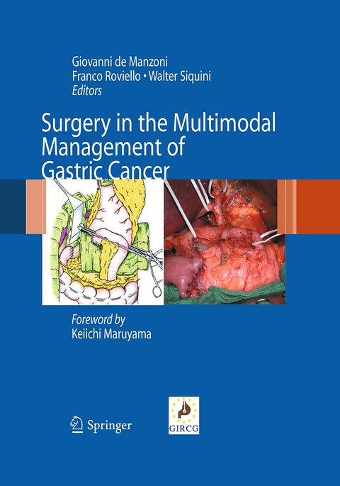 Surgery in the Multimodal Management of Gastric Cancer - 