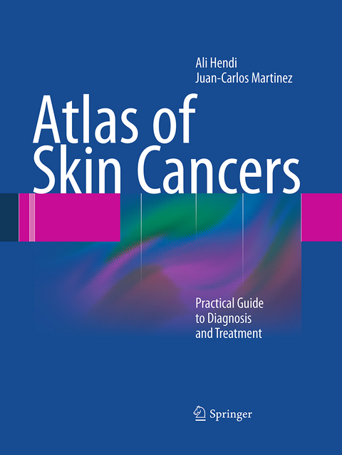 Atlas of Skin Cancers - Ali Hendi, Juan Carlos Martinez