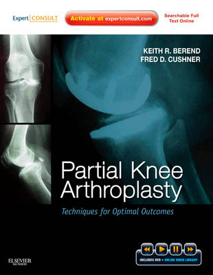 Partial Knee Arthroplasty - Keith R. Berend, Fred Cushner