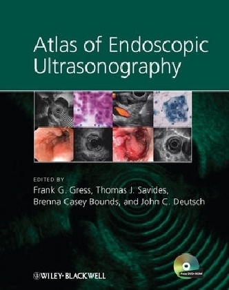 Atlas of Endoscopic Ultrasonography - 