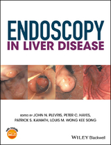 Endoscopy in Liver Disease - 