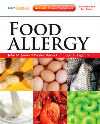 Food Allergy - John M James, A Wesley Burks, Philippe Eigenmann