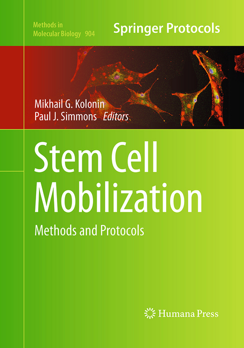 Stem Cell Mobilization - 