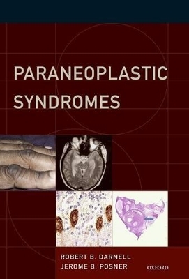 Paraneoplastic Syndromes - Robert B. Darnell, Jerome B. Posner