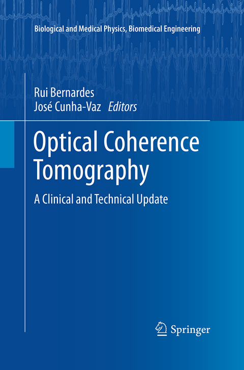 Optical Coherence Tomography - 