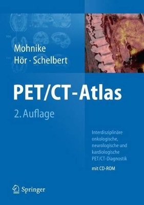 PET/CT-Atlas - 