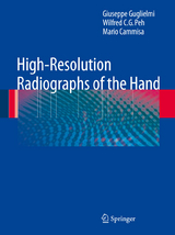 High-Resolution Radiographs of the Hand - Giuseppe Guglielmi, Wilfred C. G. Peh, Mario Cammisa