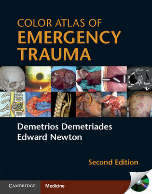 Color Atlas of Emergency Trauma - Demetrios Demetriades, Edward Newton