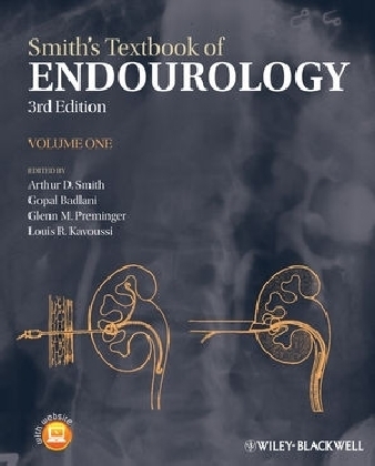 Smith's Textbook of Endourology