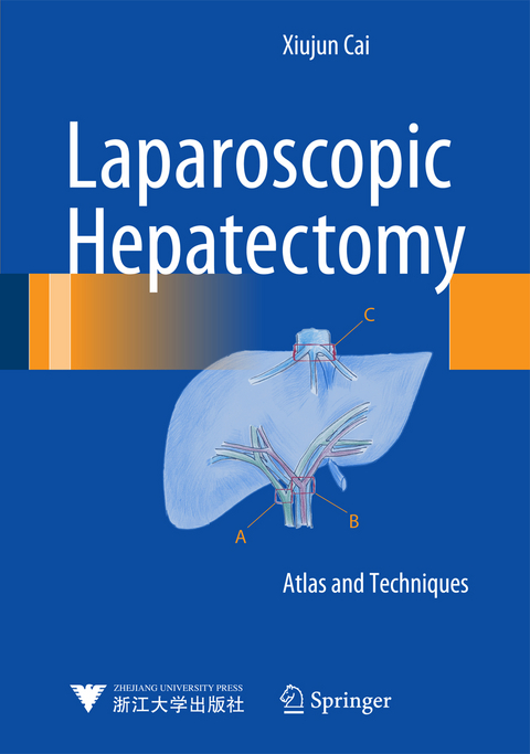 Laparoscopic Hepatectomy - Xiujun Cai