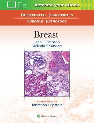 Differential Diagnoses in Surgical Pathology: Breast - Jean F. Simpson, Melinda E. Sanders