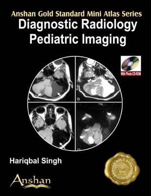 Mini Atlas of Diagnostic Radiology: Pediatric Imaging - Hariqbal Singh