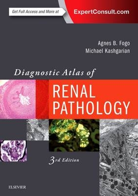 Diagnostic Atlas of Renal Pathology - Agnes B. Fogo, Michael Kashgarian