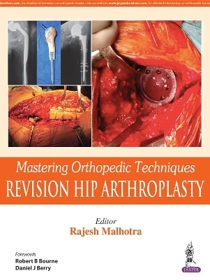 Mastering Orthopedic Techniques: Revision Total Hip Arthroplasty - Rajesh Malhotra