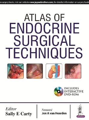 Atlas of Endocrine Surgical Techniques - Sally E Carty