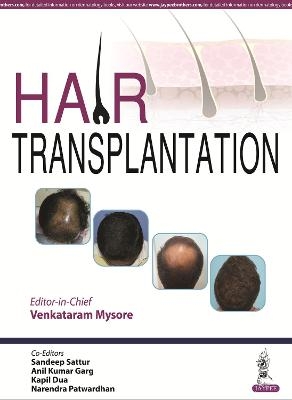 Hair Transplantation - Venkataram Mysore