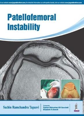 Patellofemoral Instability - Sachin Tapasvi