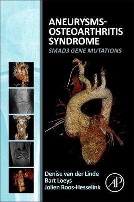 Aneurysms-Osteoarthritis Syndrome - Denise Van der Linde, Jolien Roos-Hesselink, Bart L. Loeys