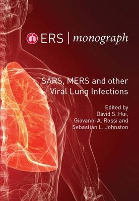 SARS, Mers and Other Viral Lung Infections - 