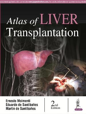 Atlas of Liver Transplantation - Ernesto Molmenti, Eduardo de Santibanes, Martin de Santibanes