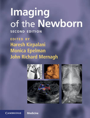 Imaging of the Newborn - 