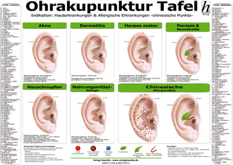 Ohrakupunktur Tafel - Indikation: Hauterkrankungen & Allergische Erkrankungen - 