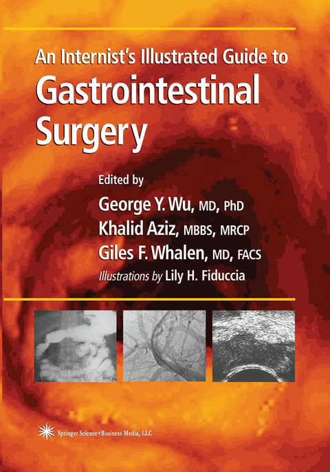 An Internist’s Illustrated Guide to Gastrointestinal Surgery - 